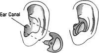 Fitting_Ear_Mould.jpg